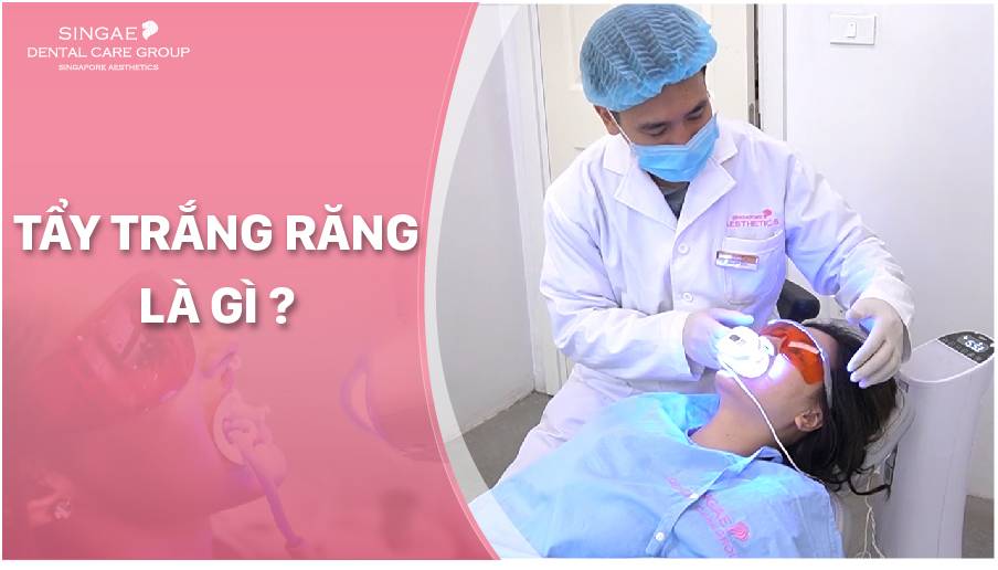 Tẩy trắng răng