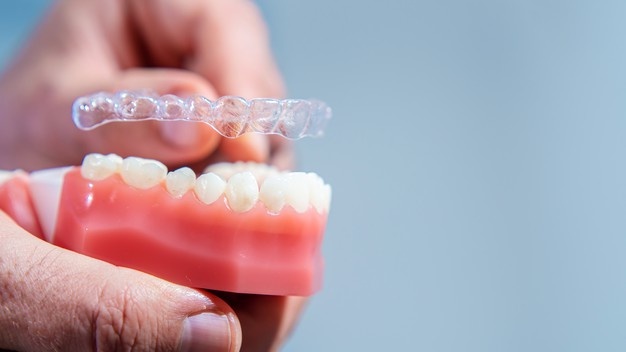 niềng răng trả góp4 1