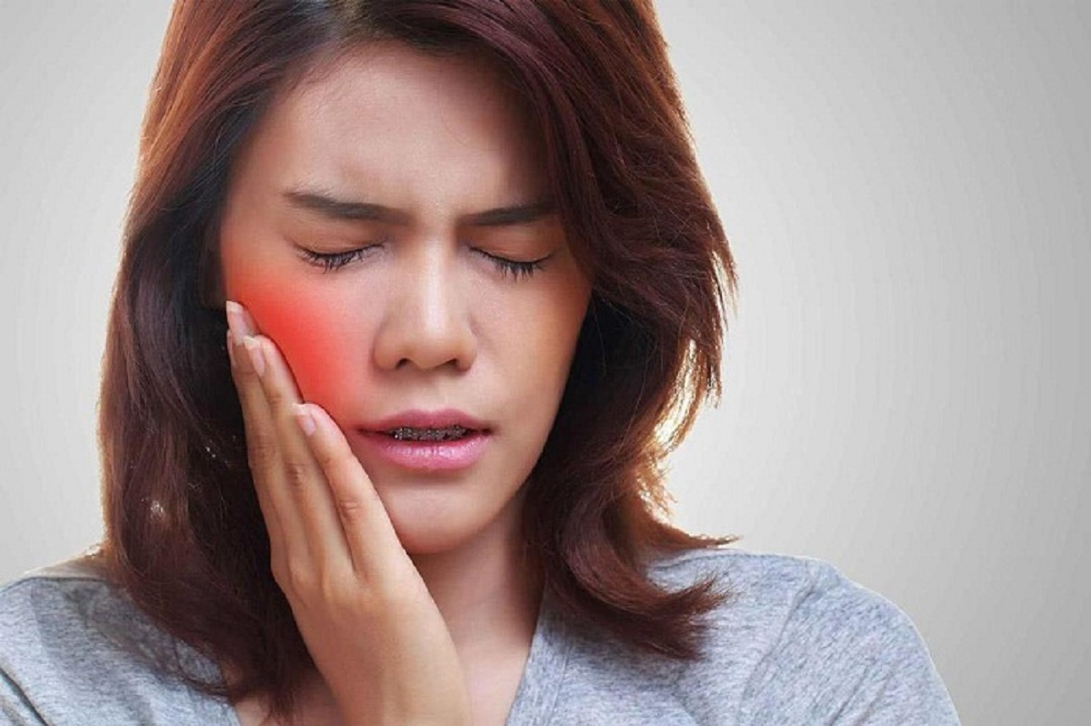 Bao nhiêu tuổi mọc răng khôn?