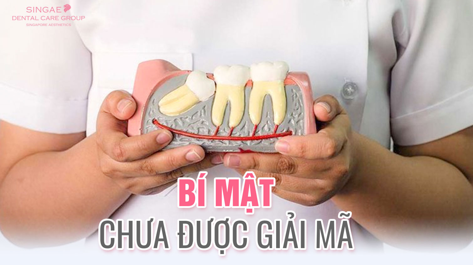 Những điều chưa được giải mã về nhổ răng khôn hàm dưới