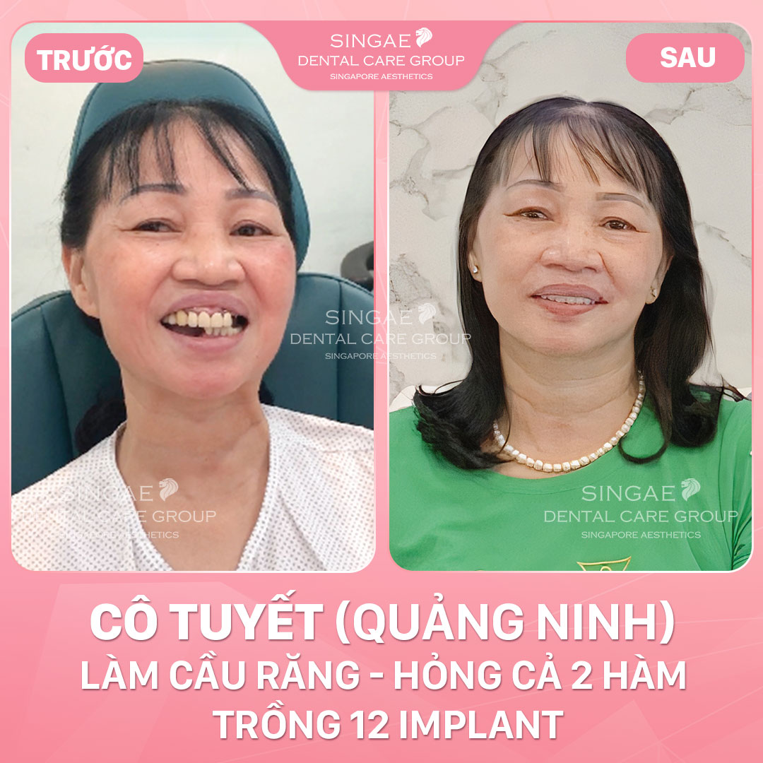 Bản sao của Cô Tuyết QN