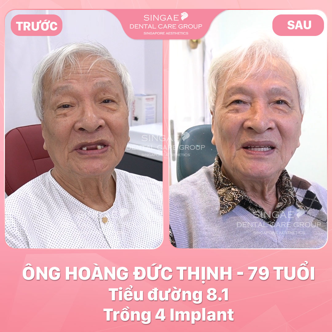 HOÀNG ĐỨC THỊNH