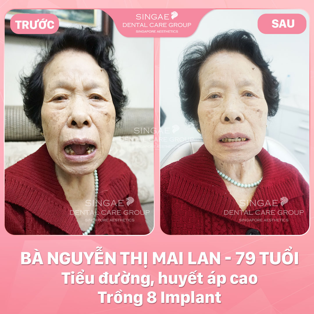 Nguyễn Thị Mai Lan