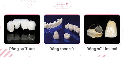 Bọc răng sứ có hại không?