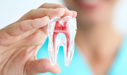 lắp răng sứ sai kỹ thuật