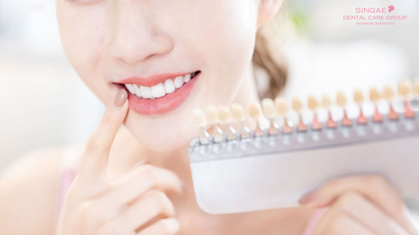 Bảng giá các loại răng sứ 