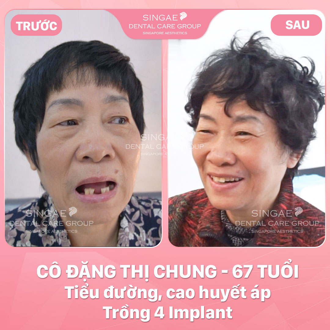 ặng Thị Chung