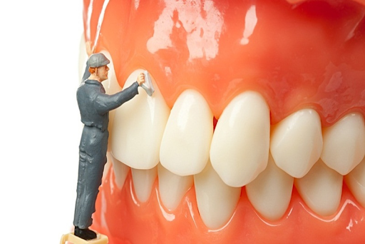 chảy máu chân răng có phải bị ung thư5