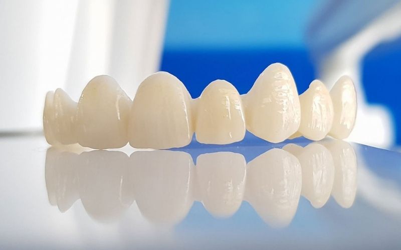 Bảng giá các loại răng sứ 