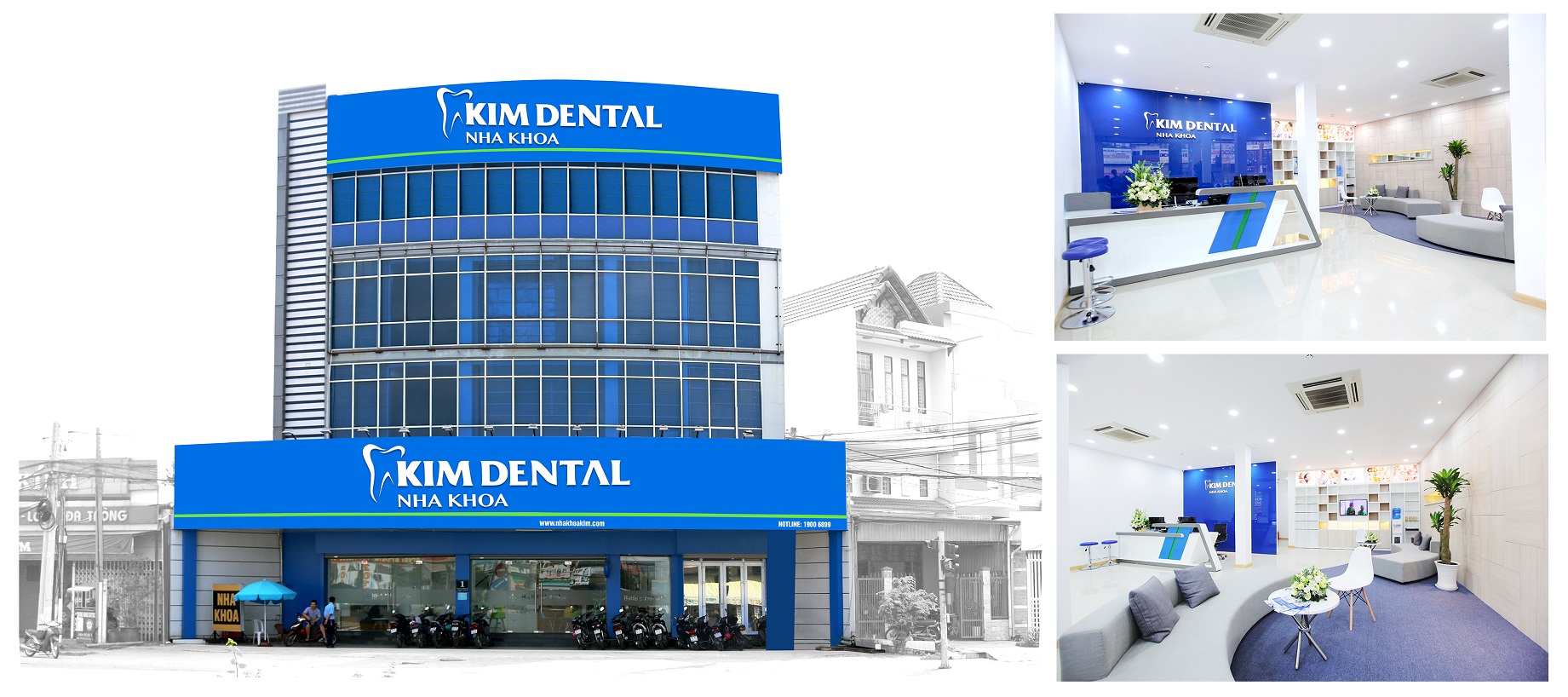 Nhổ răng khôn ở đâu tốt? Top 8+ Địa chỉ nha khoa nhổ răng khôn uy tín 15 Nhổ răng khôn ở đâu