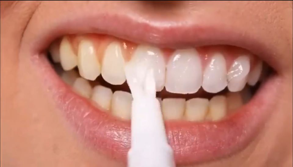 Mua bút tẩy trắng răng Nhật Bản, Hàn Quốc nào tốt? Nên mua ở đâu? 10 Bút tẩy trắng răng