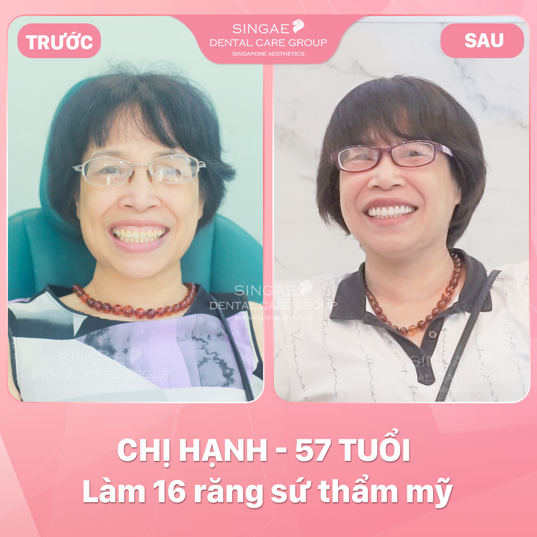 Hình ảnh khách hàng 59 Chị Hạnh