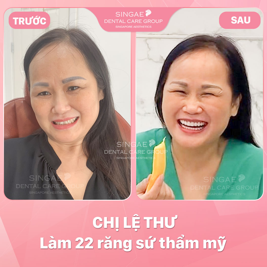 Hình ảnh khách hàng 58 Chị Lệ Thư