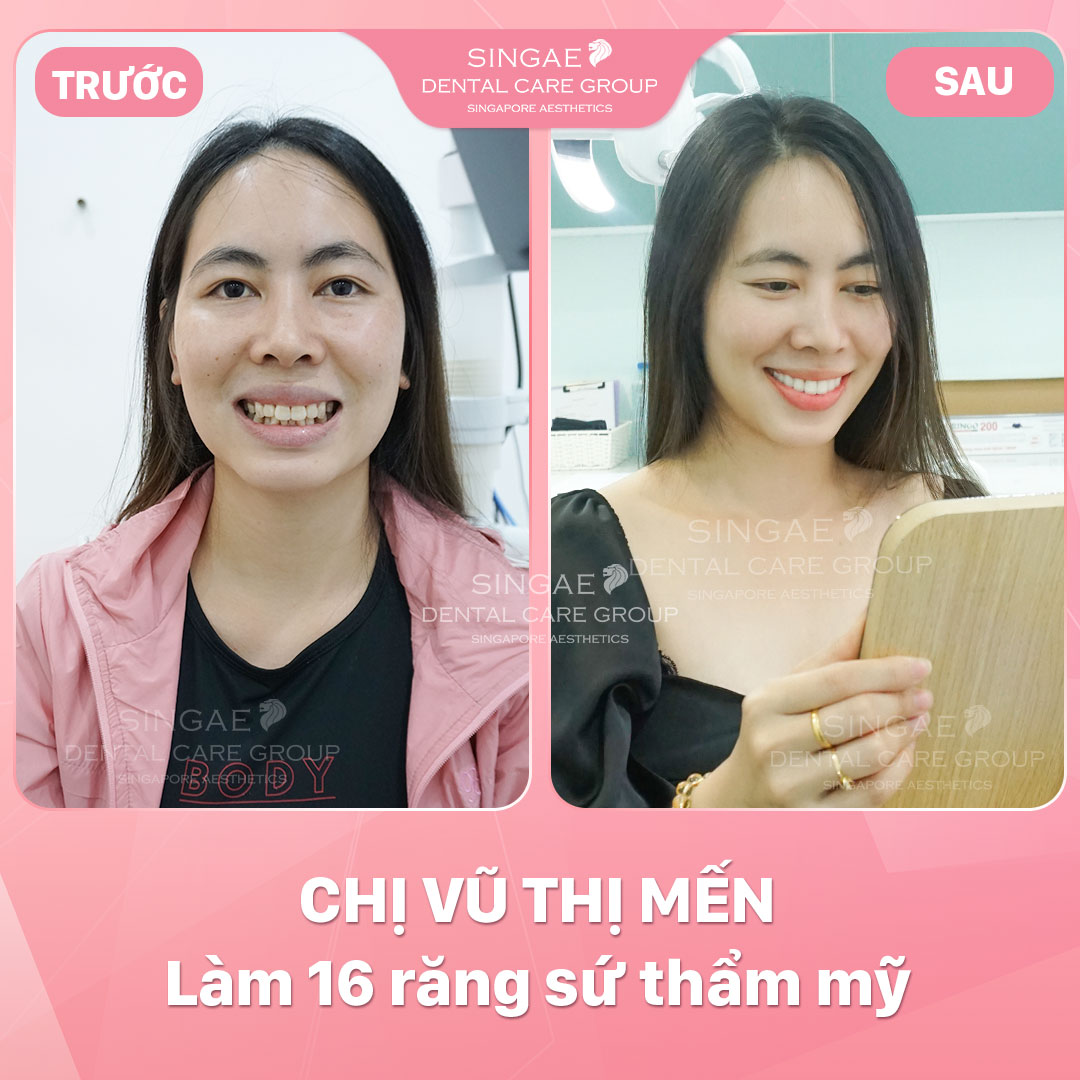 Hình ảnh khách hàng 57 Chị Mến