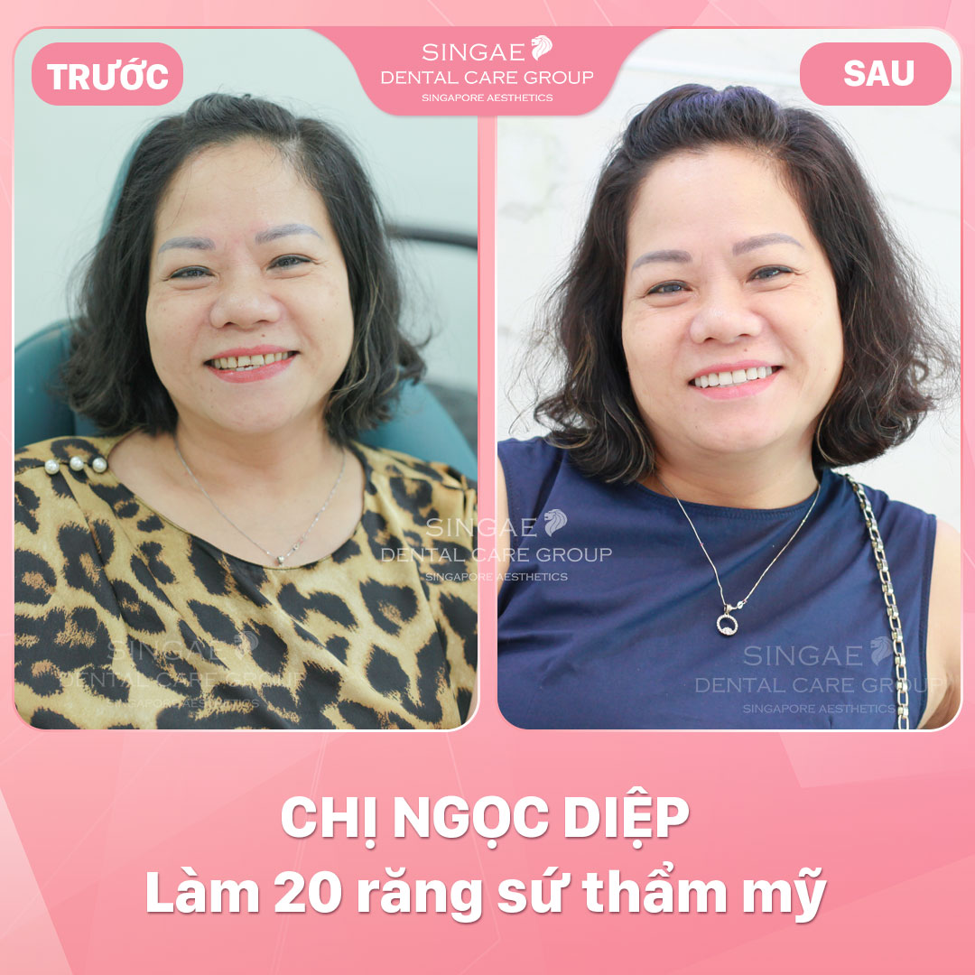 Hình ảnh khách hàng 40 Chị Ngoc Diep