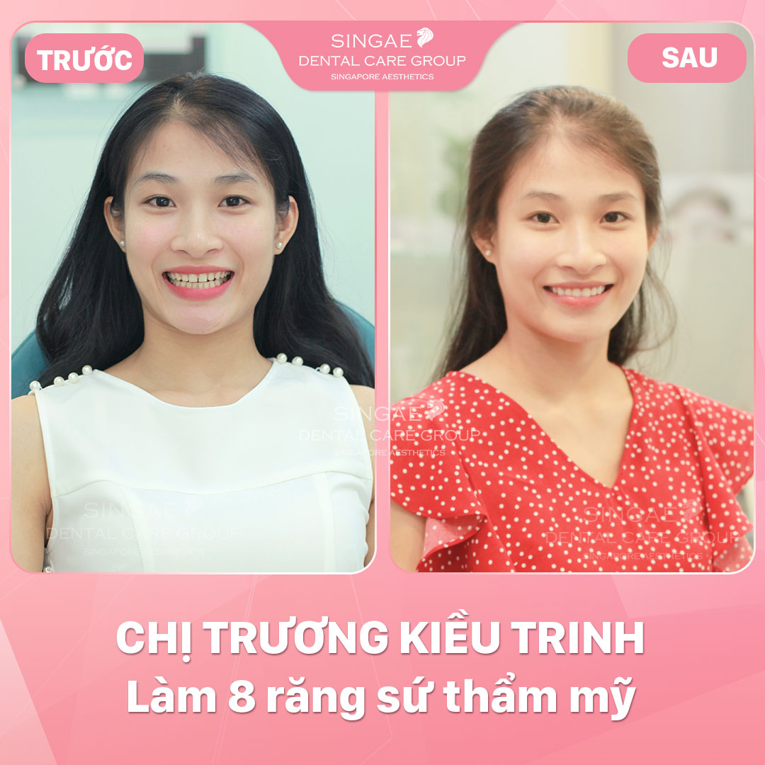 Hình ảnh khách hàng 55 Chị Trinh 1