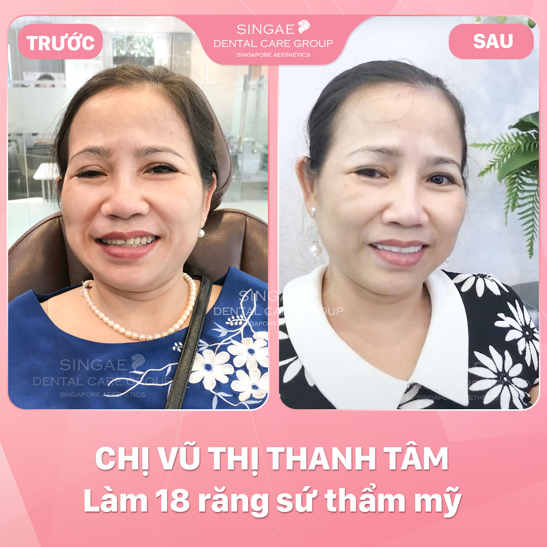 Hình ảnh khách hàng 56 Chị Tâm