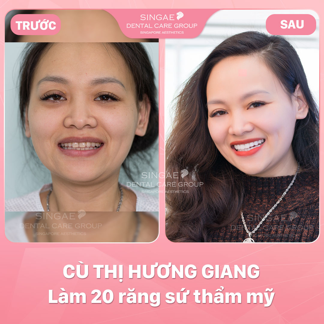 Hình ảnh khách hàng 45 Cu Thi Huong Giang