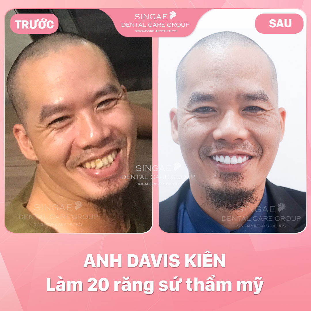 Hình ảnh khách hàng 46 Davis Kien