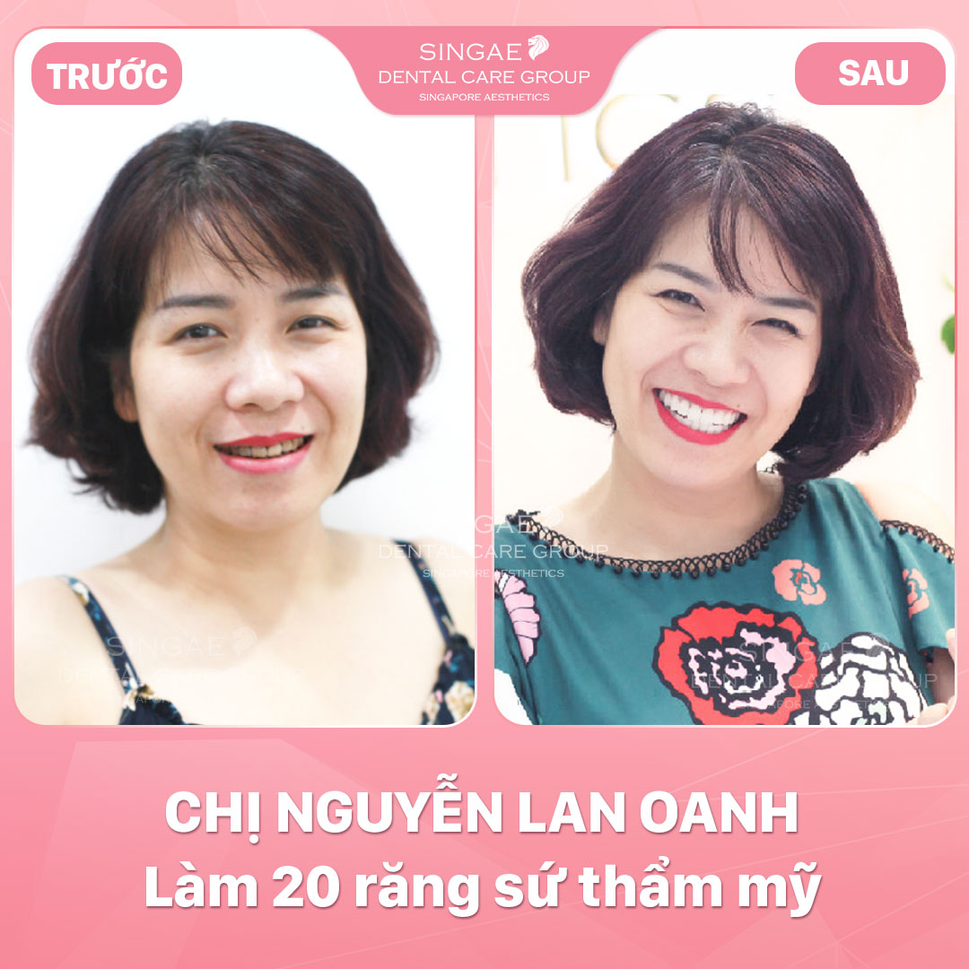 Hình ảnh khách hàng 34 Nguyen Loan Oanh