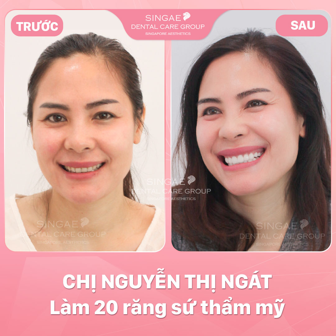 Hình ảnh khách hàng 50 Nguyen Thi Ngat