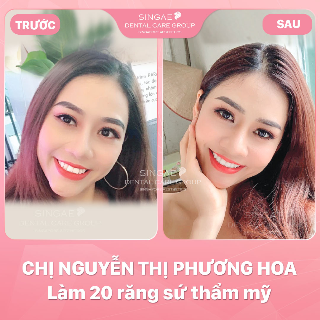 Hình ảnh khách hàng 43 Nguyen Thi Phuong Hoa