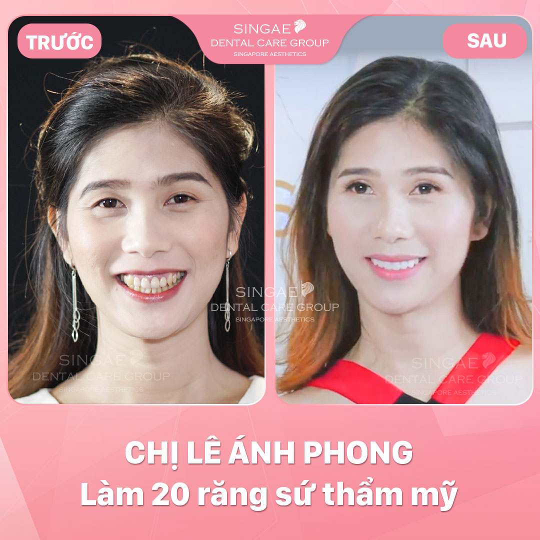 Hình ảnh khách hàng 39 chị lê ánh phong