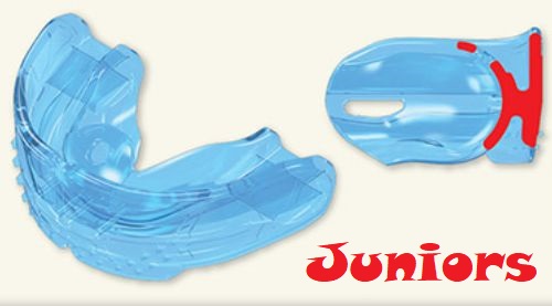 [ Niềng răng Trainer là gì? ] Khi nào nên dùng và giá bao nhiêu?