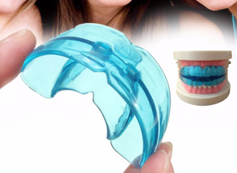 [ Niềng răng Trainer là gì? ] Khi nào nên dùng và giá bao nhiêu?