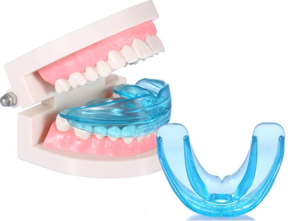 niềng răng Trainer6