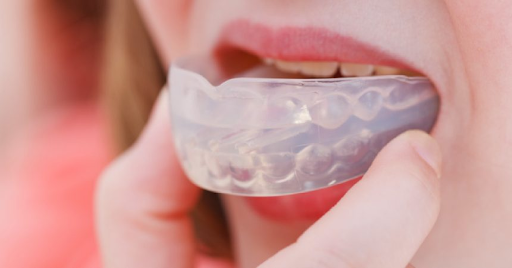 Niềng răng silicon là gì? Hàm Trainer có giá bao nhiêu? Niềng răng Silicon có tốt hay không? Có nên dùng hay không?