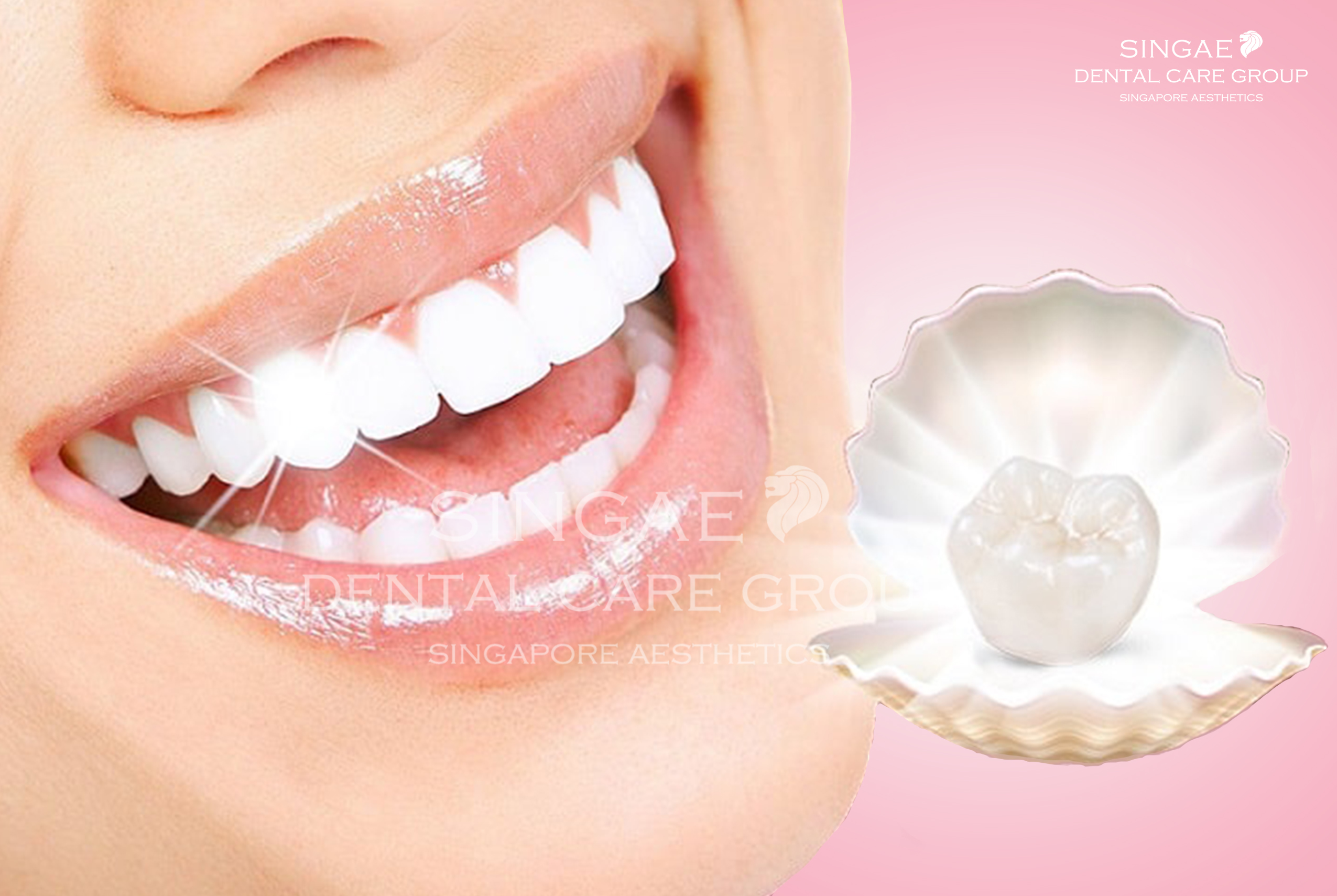 Răng sứ HT Smile 