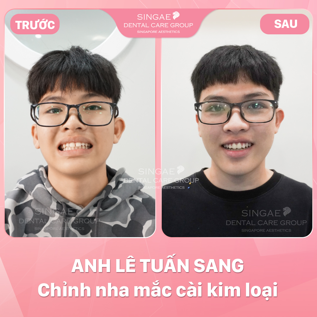Hình ảnh khách hàng 21 LÊ TUẤN SANG