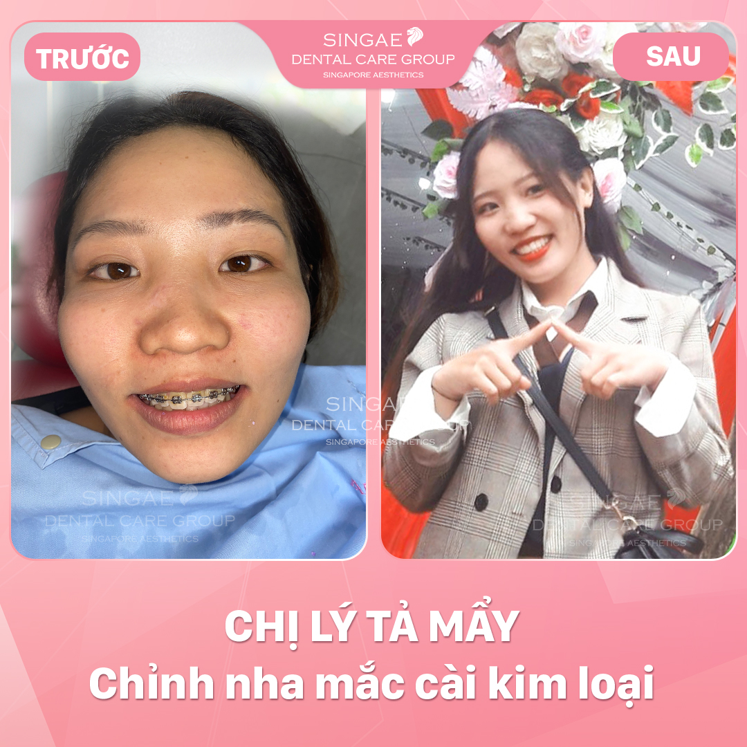 Hình ảnh khách hàng 23 LÝ TẢ MẨY