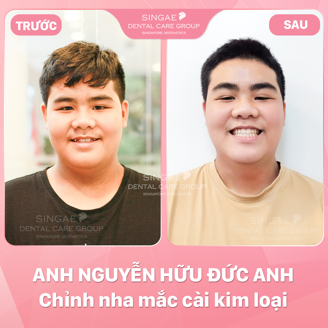 Hình ảnh khách hàng 17 NGUYỄN HỮU ĐỨC ANH