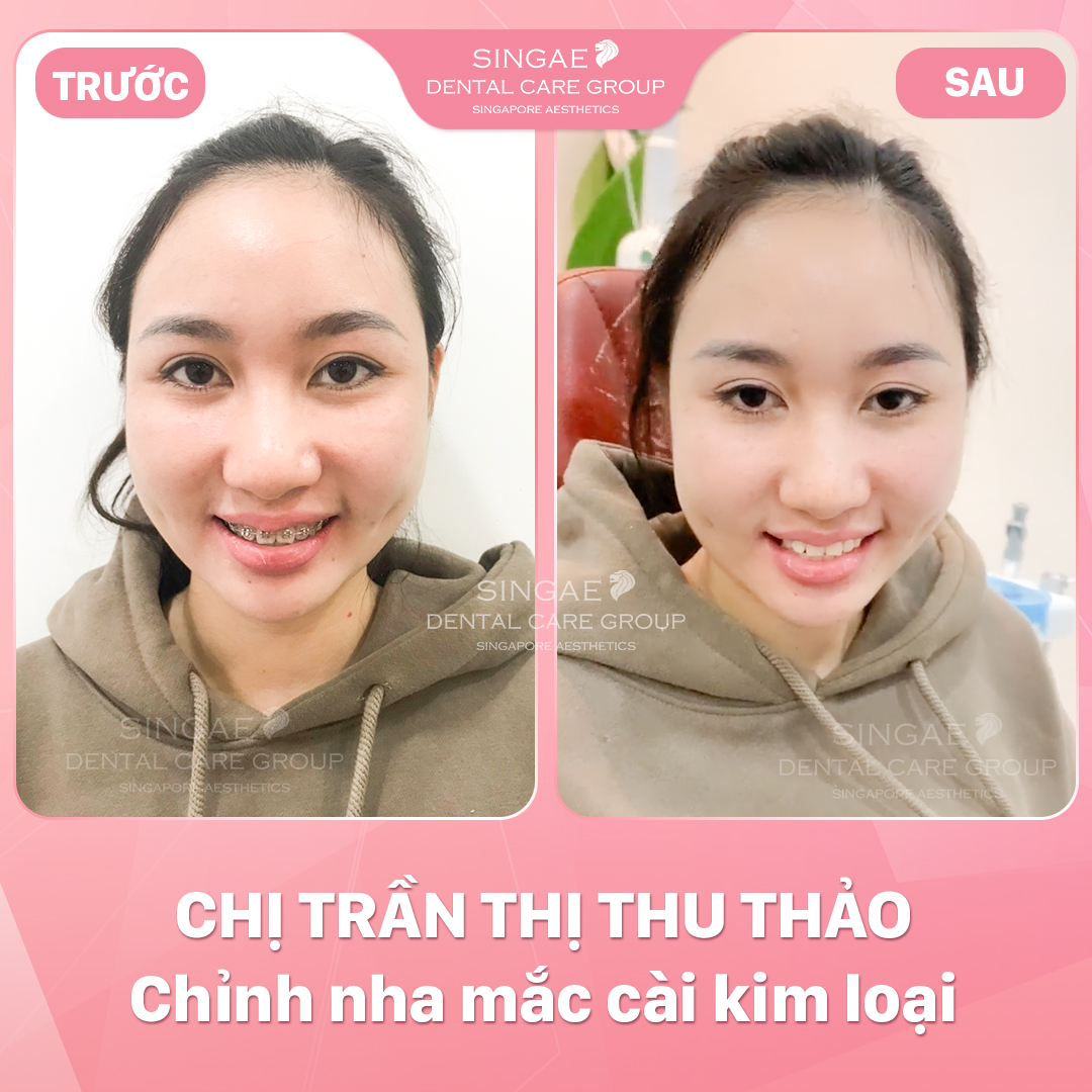 Hình ảnh khách hàng 32 TRẦN THỊ THU THẢO