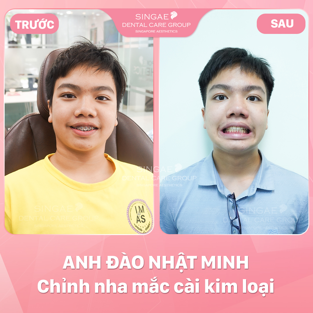 Hình ảnh khách hàng 20 O NHẬT MINH
