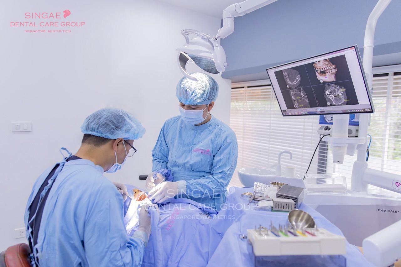 Cấy ghép răng Implant an toàn với 3 tiêu chuẩn vô trùng, vô khuẩn