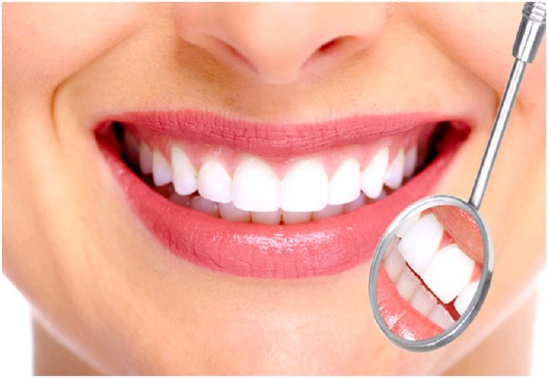 Cuộc đối đầu giữa Răng sứ kim loại và Răng sứ Titan