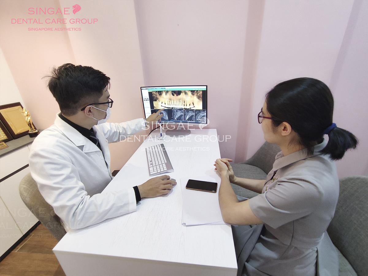 [ Top 4 ] vấn đề bạn nên trao đổi với bác sĩ trước khi trồng răng Implant