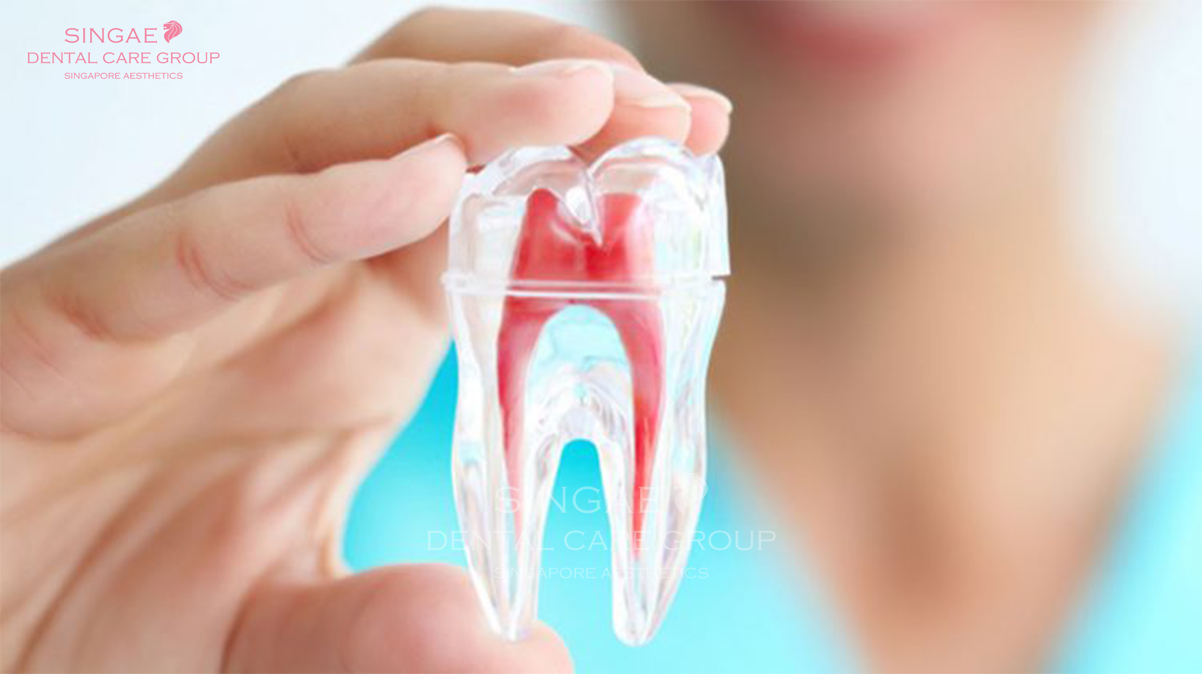 Giải đáp: Niềng răng có được vĩnh viễn không? 5 Tình trạng răng