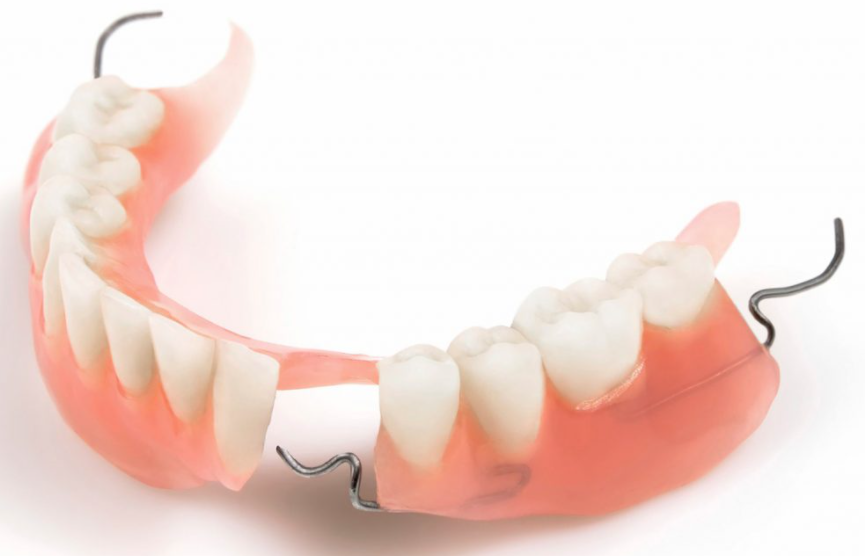 Các loại hàm giả tháo lắp? Ưu nhược điểm của hàm giả tháo lắp? 9 Hàm giả tháo lắp