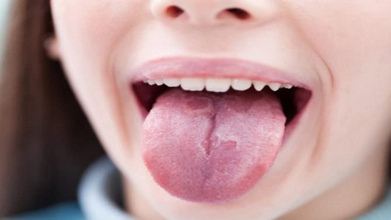 bệnh răng miệng ở trẻ em
