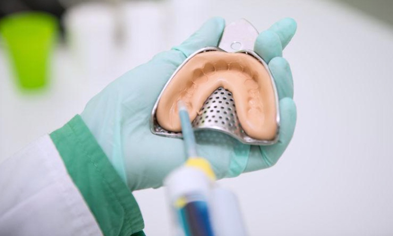 Lấy dấu Implant là gì? Các phương pháp lấy dấu hiện nay?