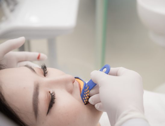 Lấy dấu Implant là gì? Các phương pháp lấy dấu hiện nay?