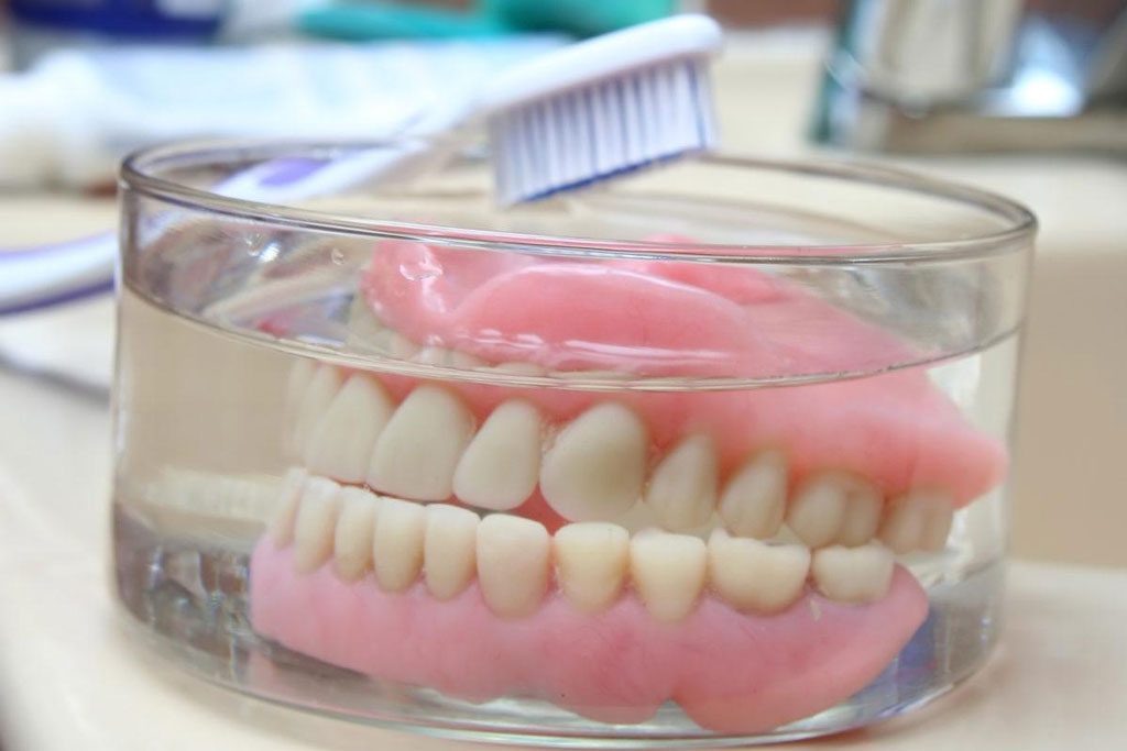 Răng giả bị rơi: Nguyên nhân, Cách xử lý, Cách vệ sinh