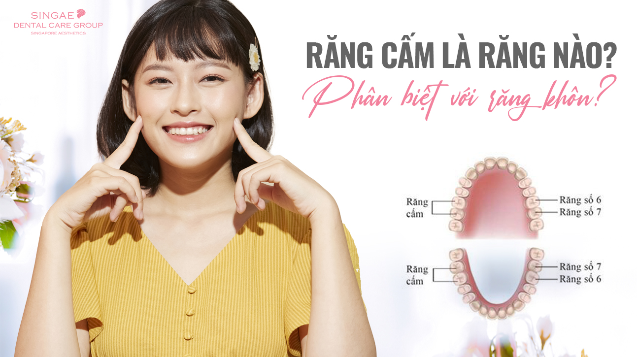 Răng cấm là gì? Phân biệt răng cấm và răng khôn như thế nào