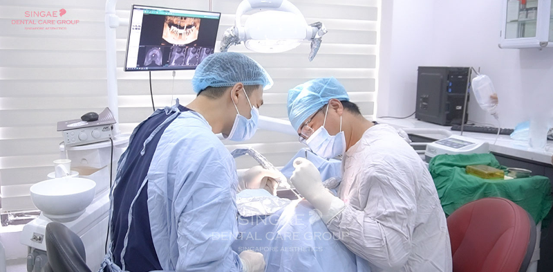 Hậu quả của việc cắm trụ Implant sai kỹ thuật