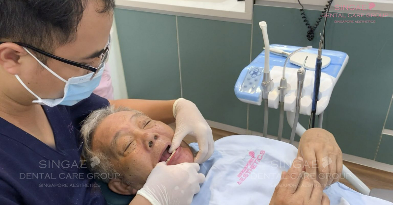 Nên chọn phương pháp trồng răng nào