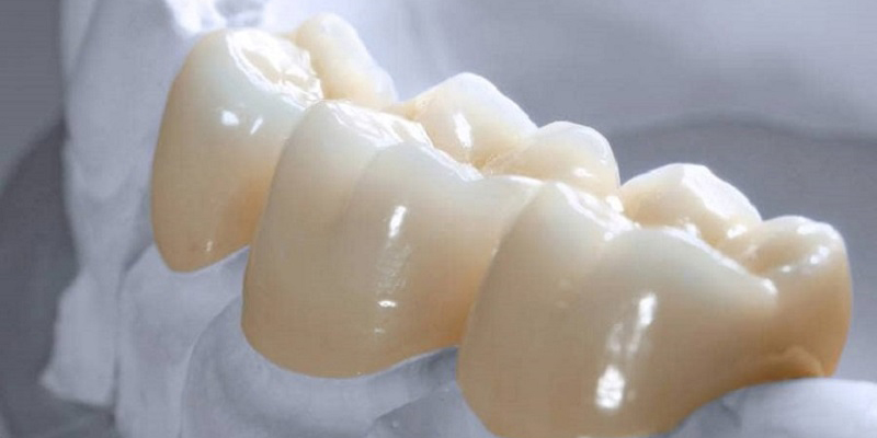 Những yếu tố liên quan đến độ bền